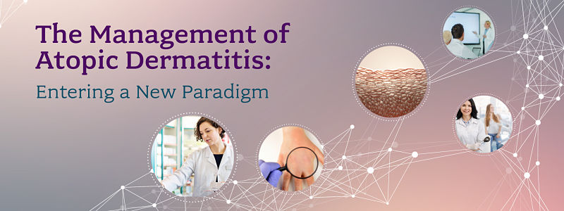 The Management of Atopic Dermatitis: Entering a New Paradigm